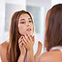 Severe Blemishes