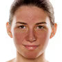 Skin Care Tips for Calming Redness
