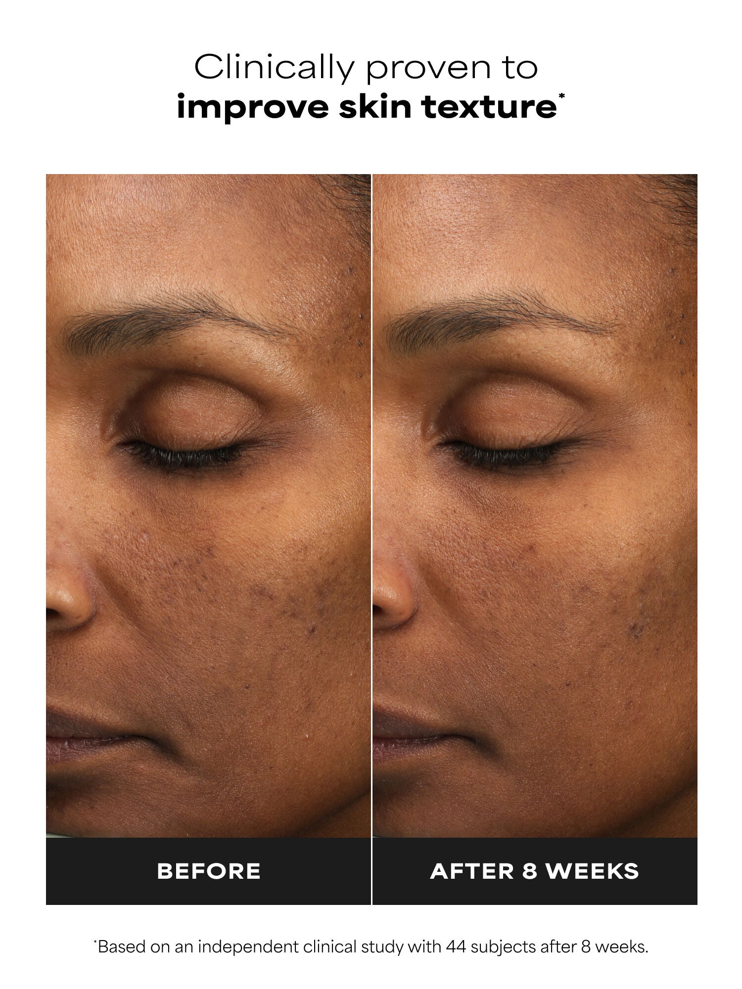SKIN PERFECTING 6% Mandelic Acid + 2% Lactic Acid Liquid Exfoliant