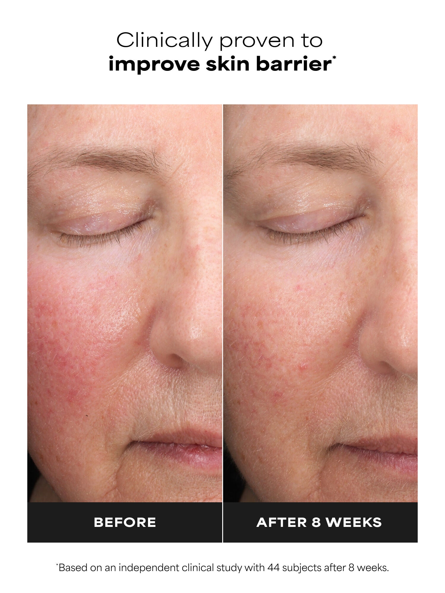 SKIN PERFECTING 6% Mandelic Acid + 2% Lactic Acid Liquid Exfoliant