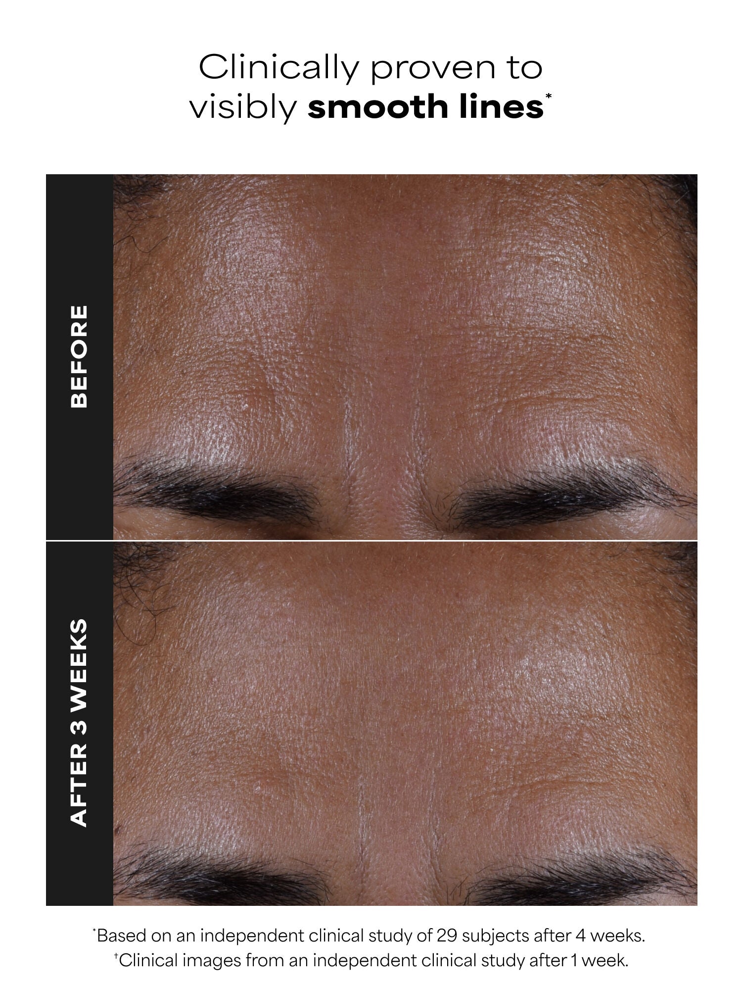 SKIN PERFECTING 2% BHA Liquid Exfoliant