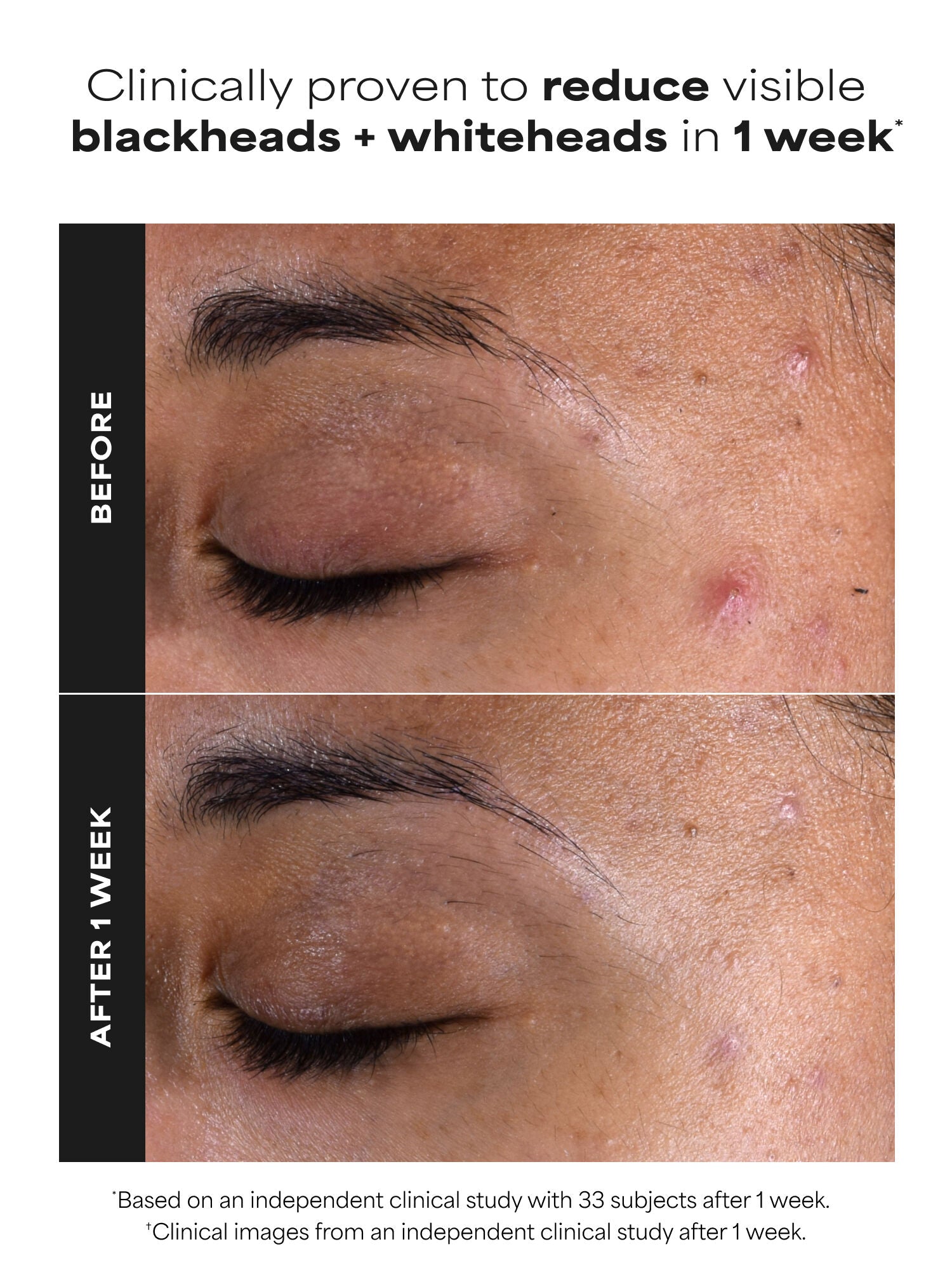 SKIN PERFECTING 2% BHA Liquid Exfoliant