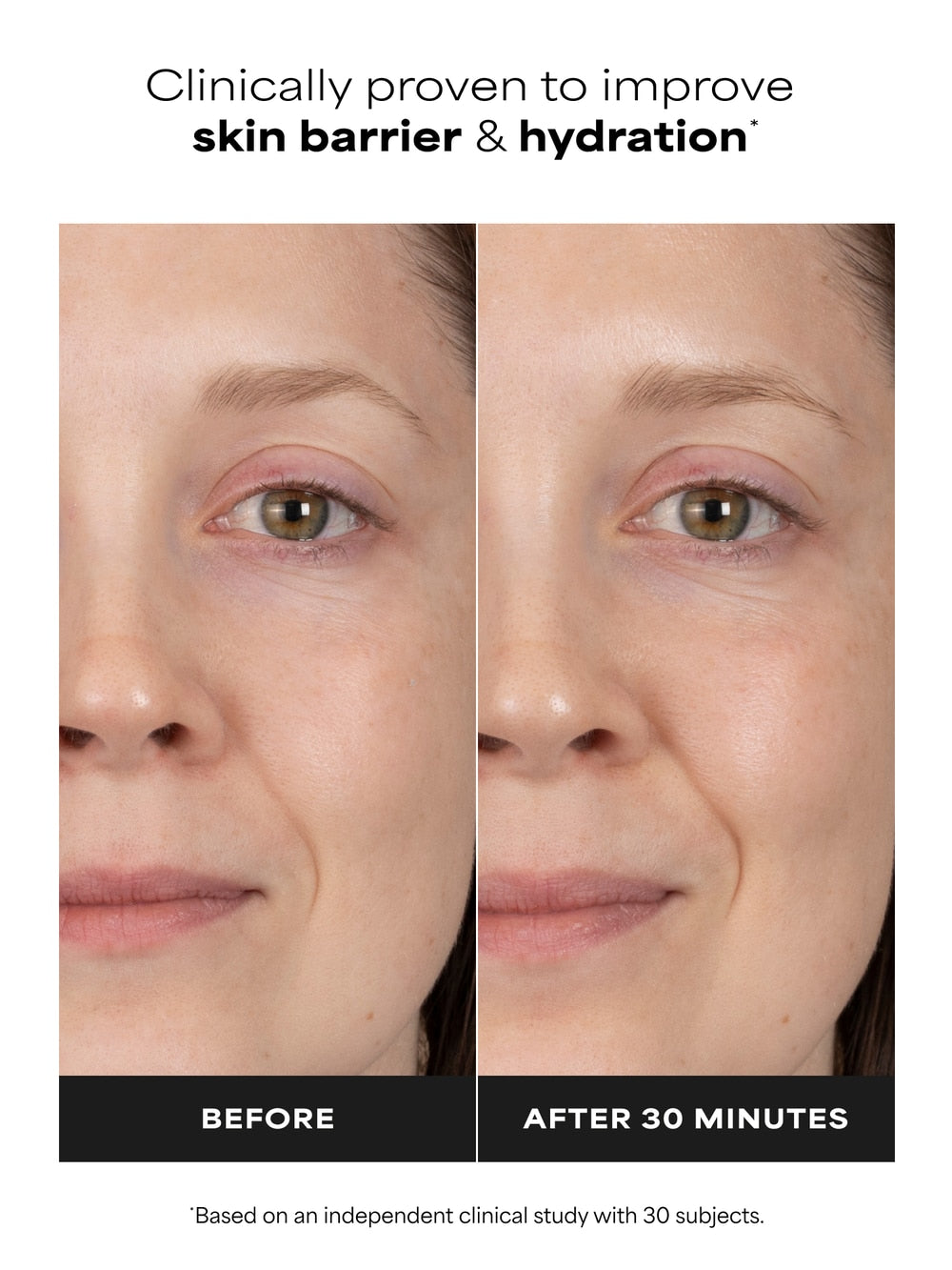 RESIST Barrier Repair Advanced Moisturizer