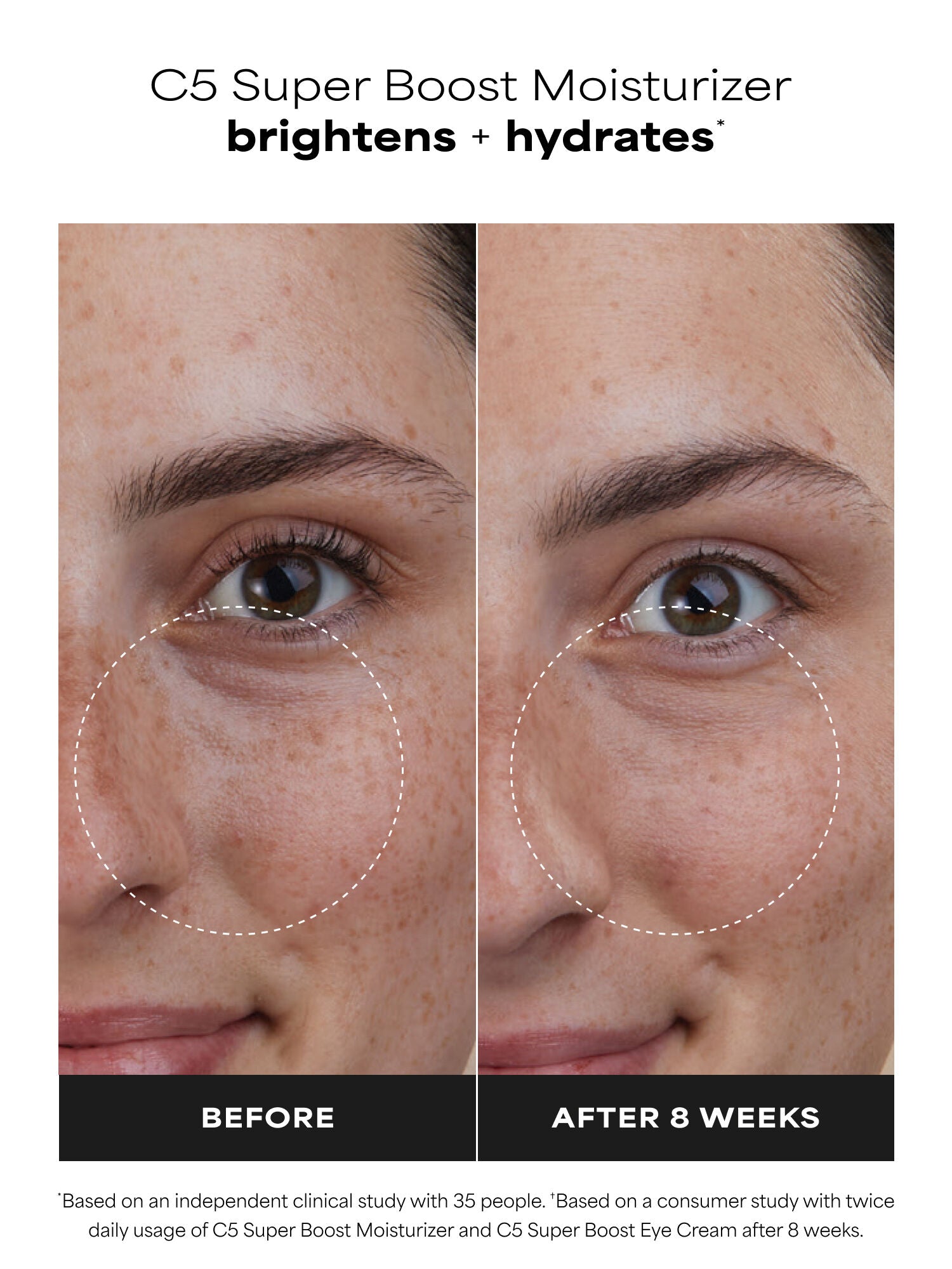C5 Super Boost Moisturizer