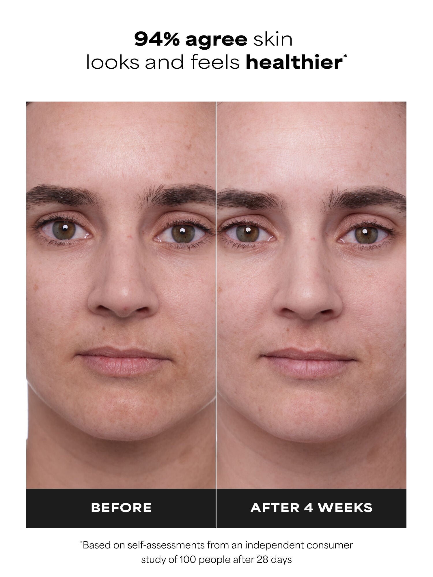 CLINICAL 1% Retinol Treatment