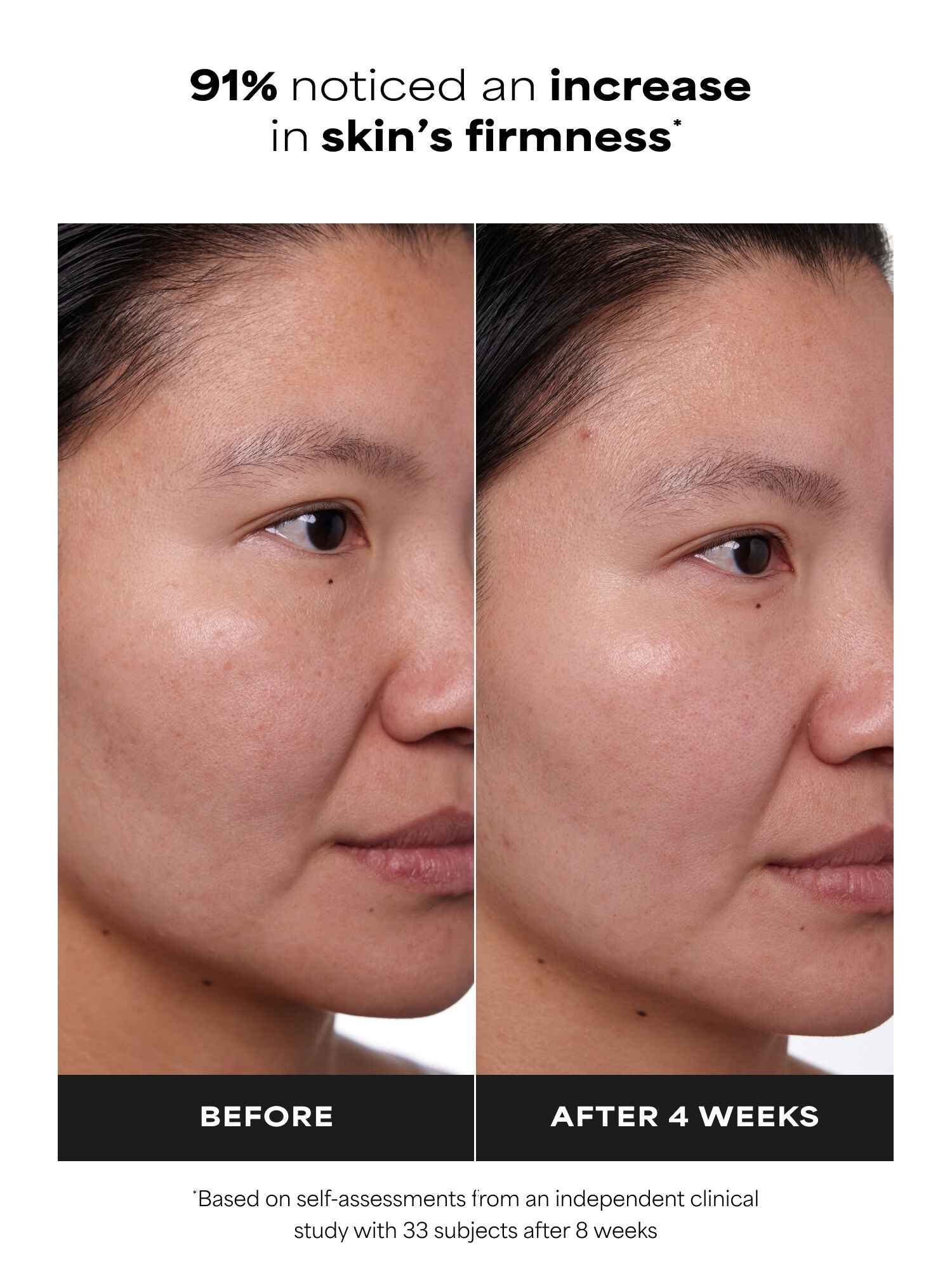 CLINICAL 1% Retinol Treatment