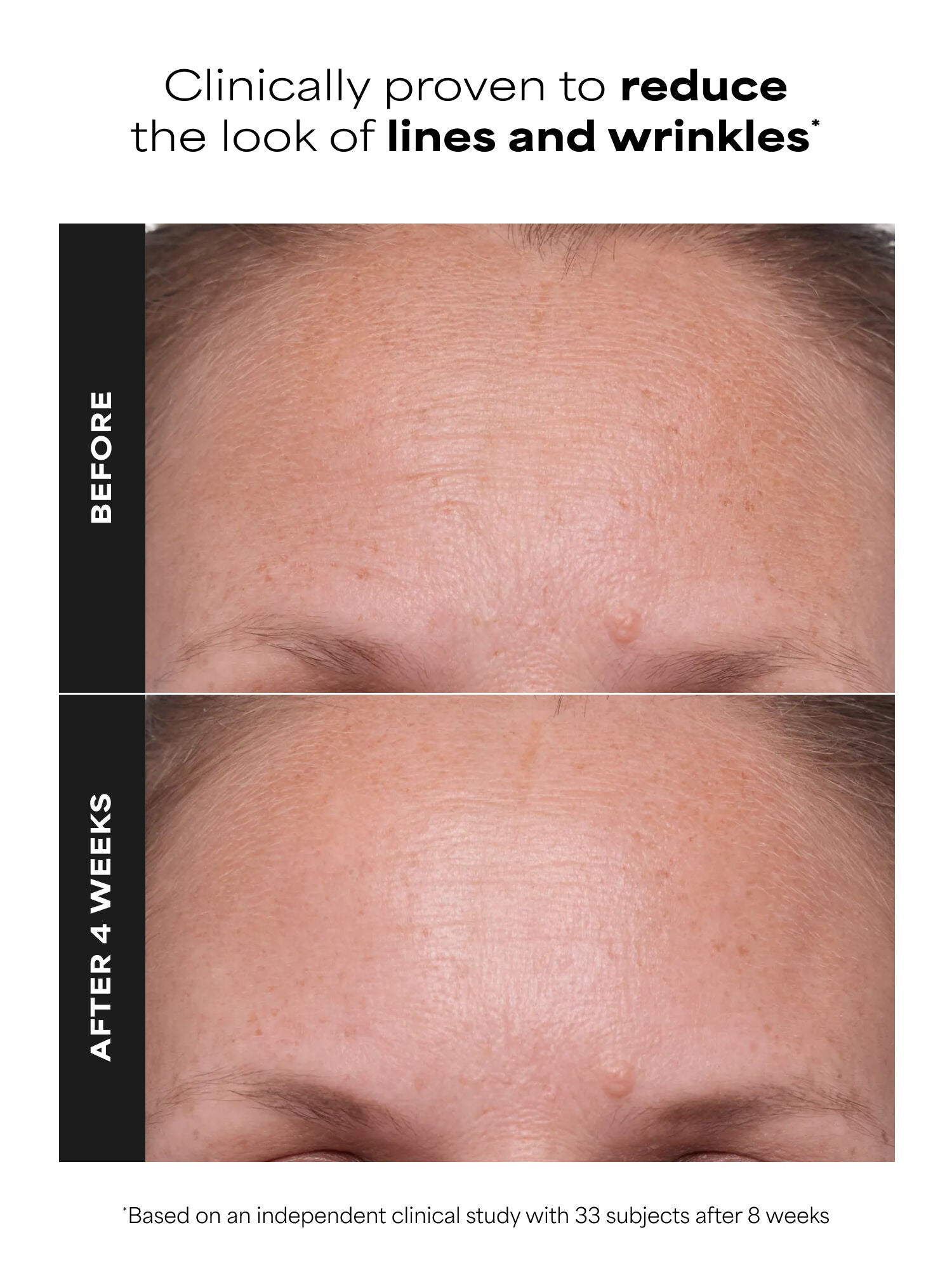 CLINICAL 1% Retinol Treatment