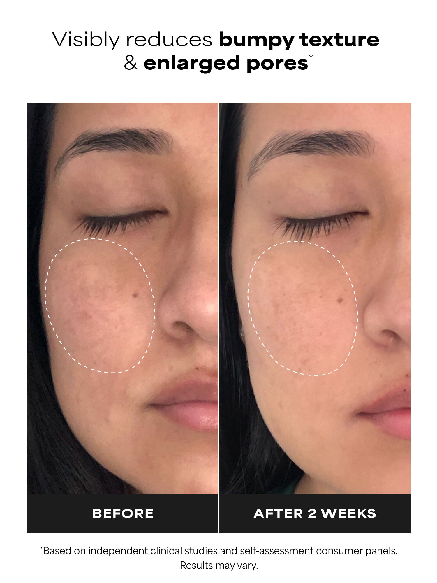 CLINICAL Niacinamide 20% Treatment