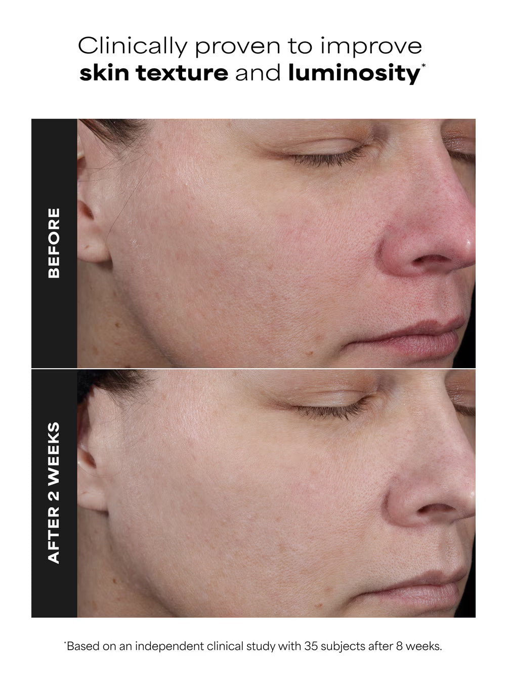 CLINICAL PRO Retinaldehyde Treatment