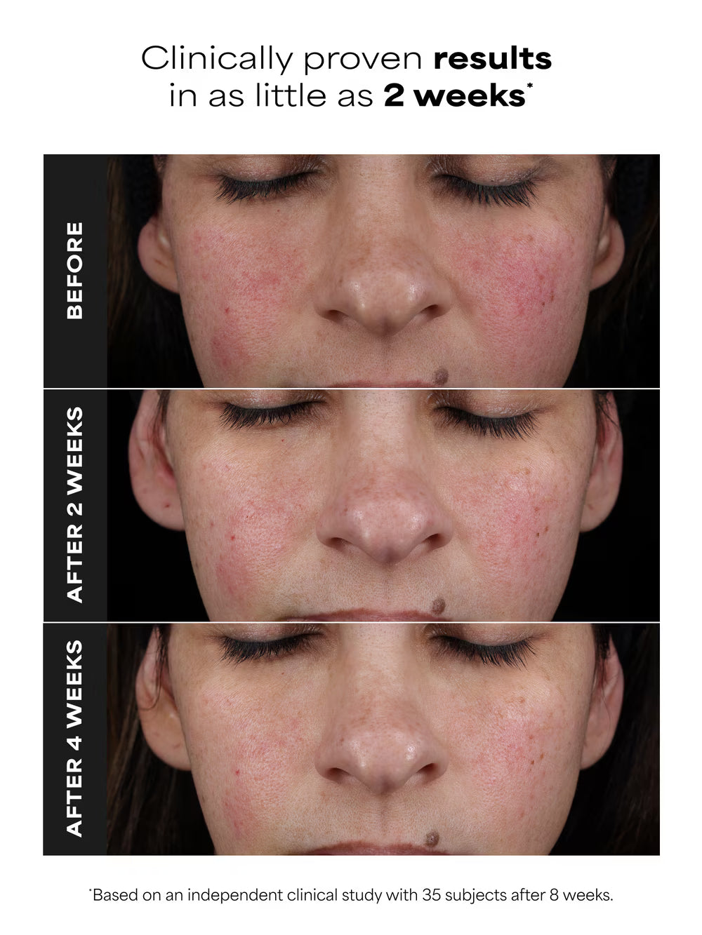 CLINICAL PRO Retinaldehyde Treatment