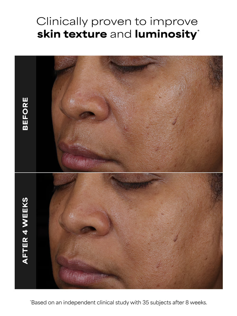 CLINICAL PRO Retinaldehyde Treatment