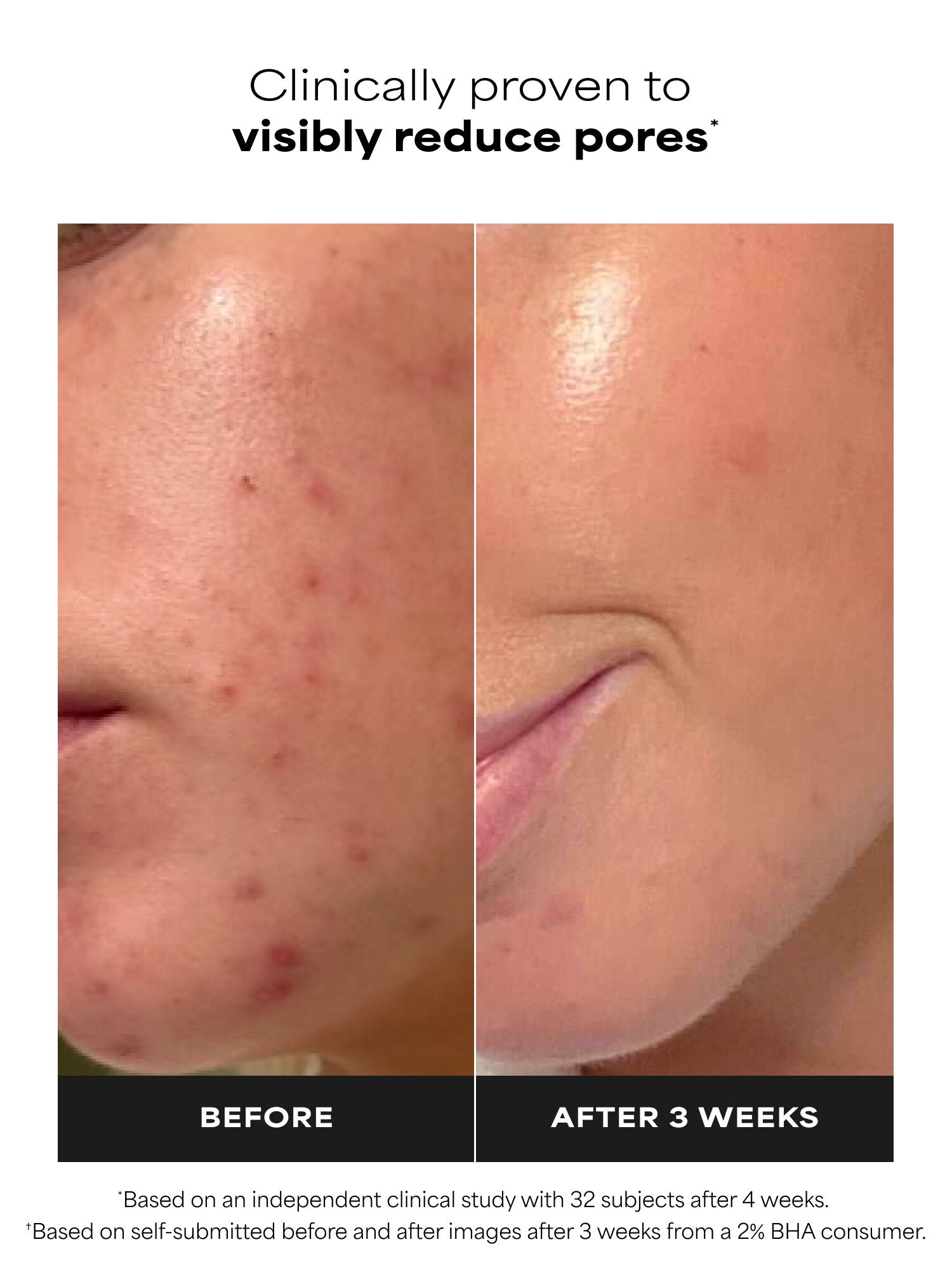 SKIN PERFECTING 2% BHA Liquid Exfoliant