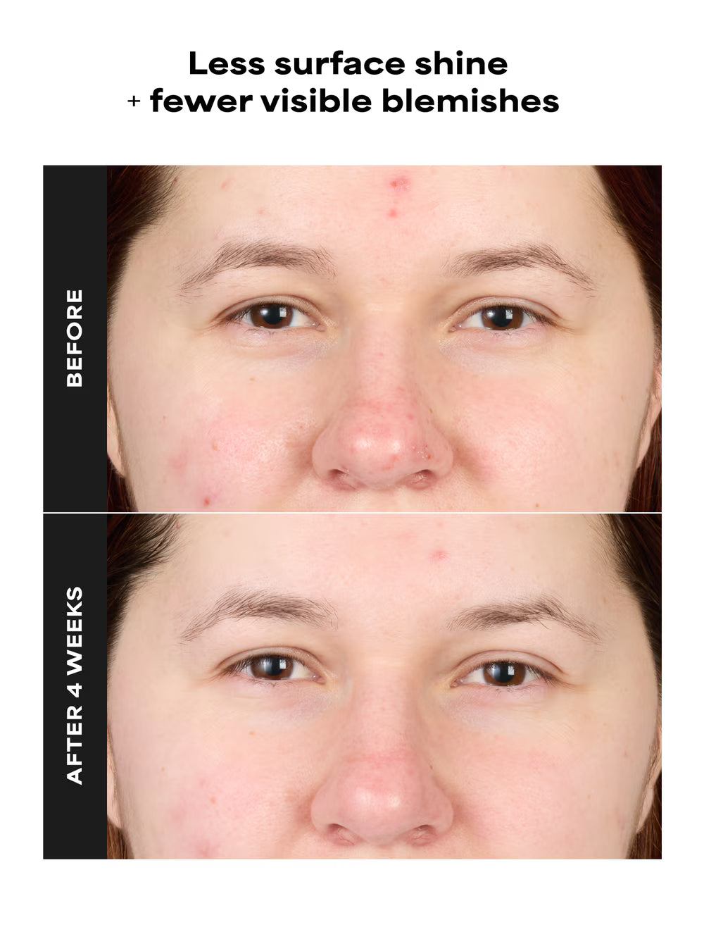 SKIN PERFECTING 4% BHA Advanced Exfoliating Serum Toner