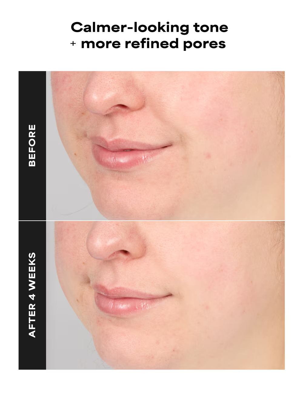 SKIN PERFECTING 4% BHA Advanced Exfoliating Serum Toner