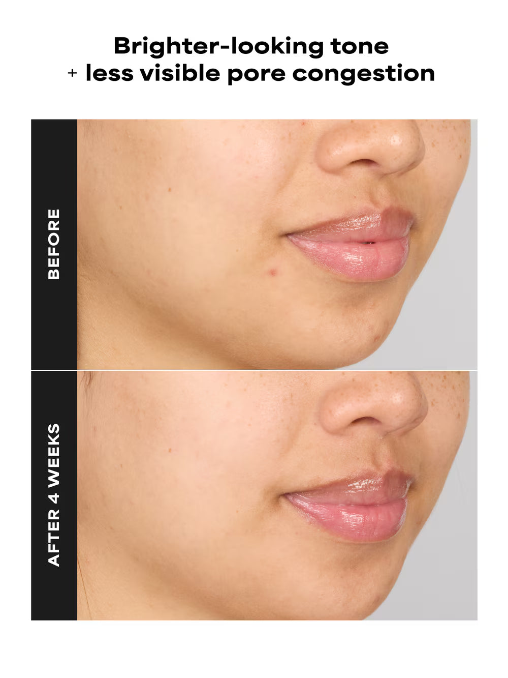 SKIN PERFECTING 4% BHA Advanced Exfoliating Serum Toner