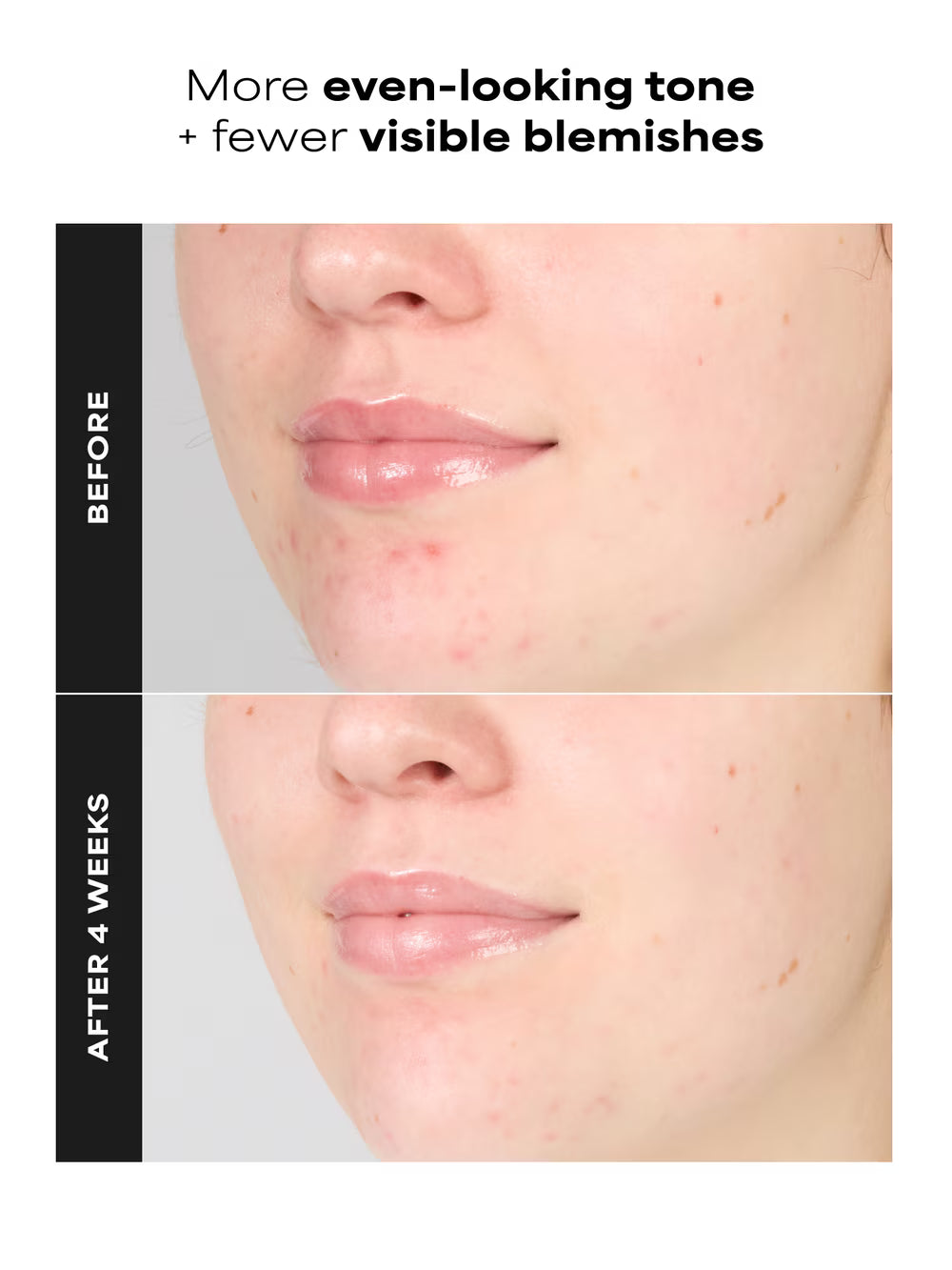 SKIN PERFECTING 1% BHA Gentle Exfoliating Gel Toner