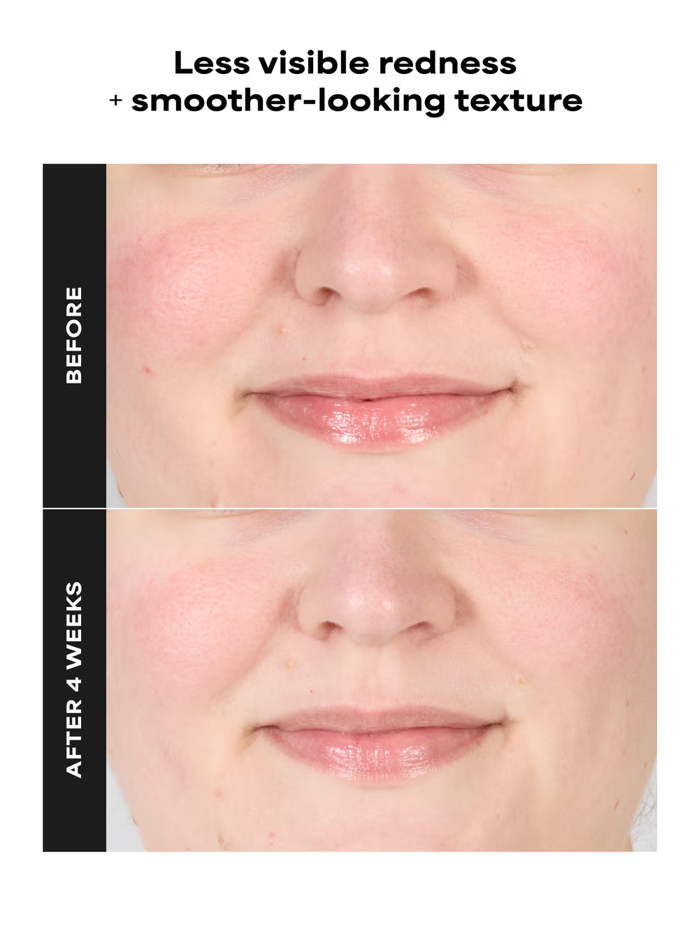SKIN PERFECTING 1% BHA Gentle Exfoliating Gel Toner