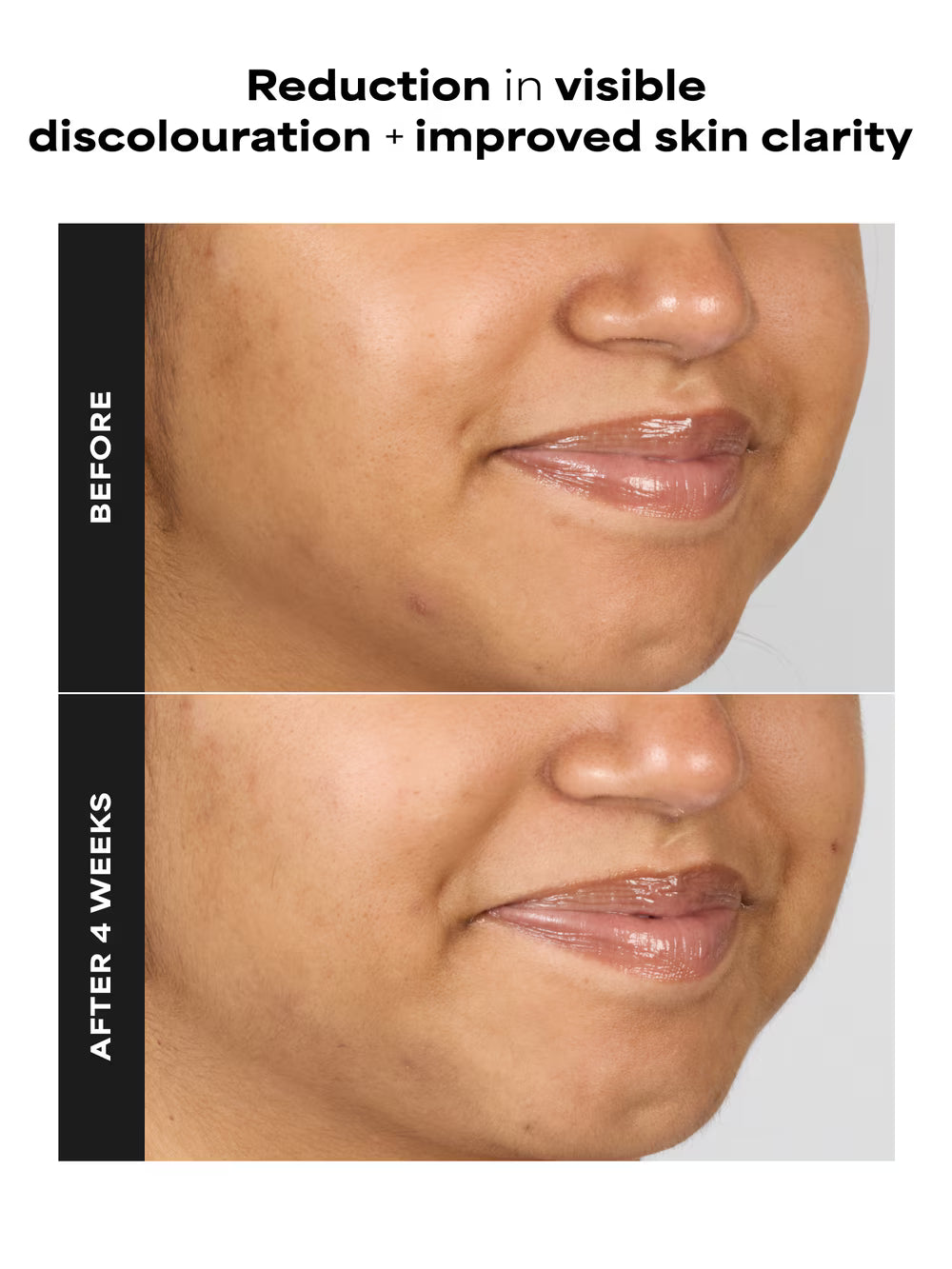 SKIN PERFECTING 1% BHA Gentle Exfoliating Gel Toner