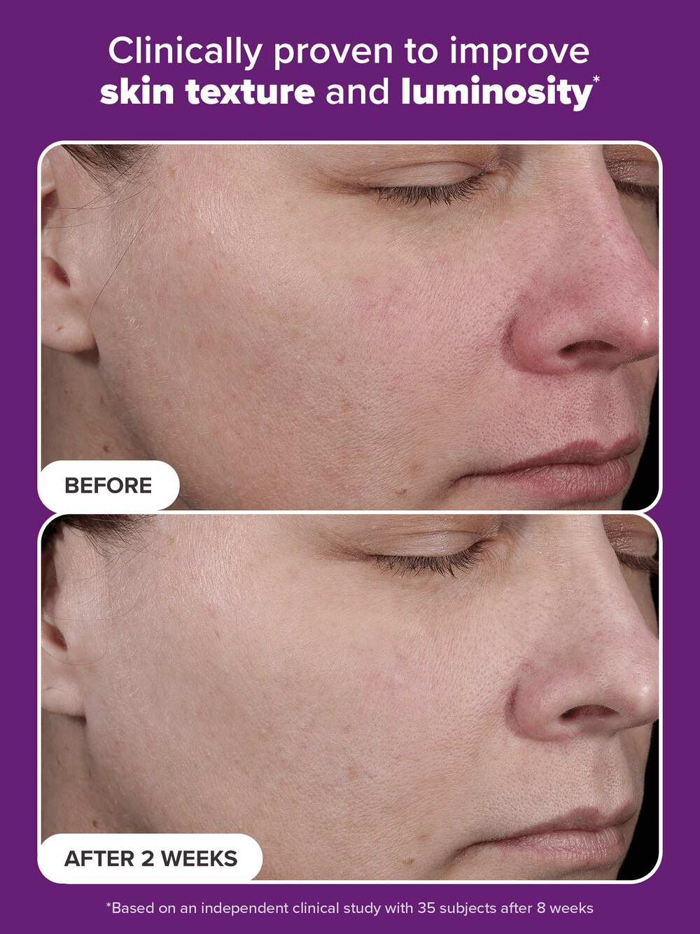 CLINICAL PRO Retinaldehyde Treatment | Paula's Choice Australia