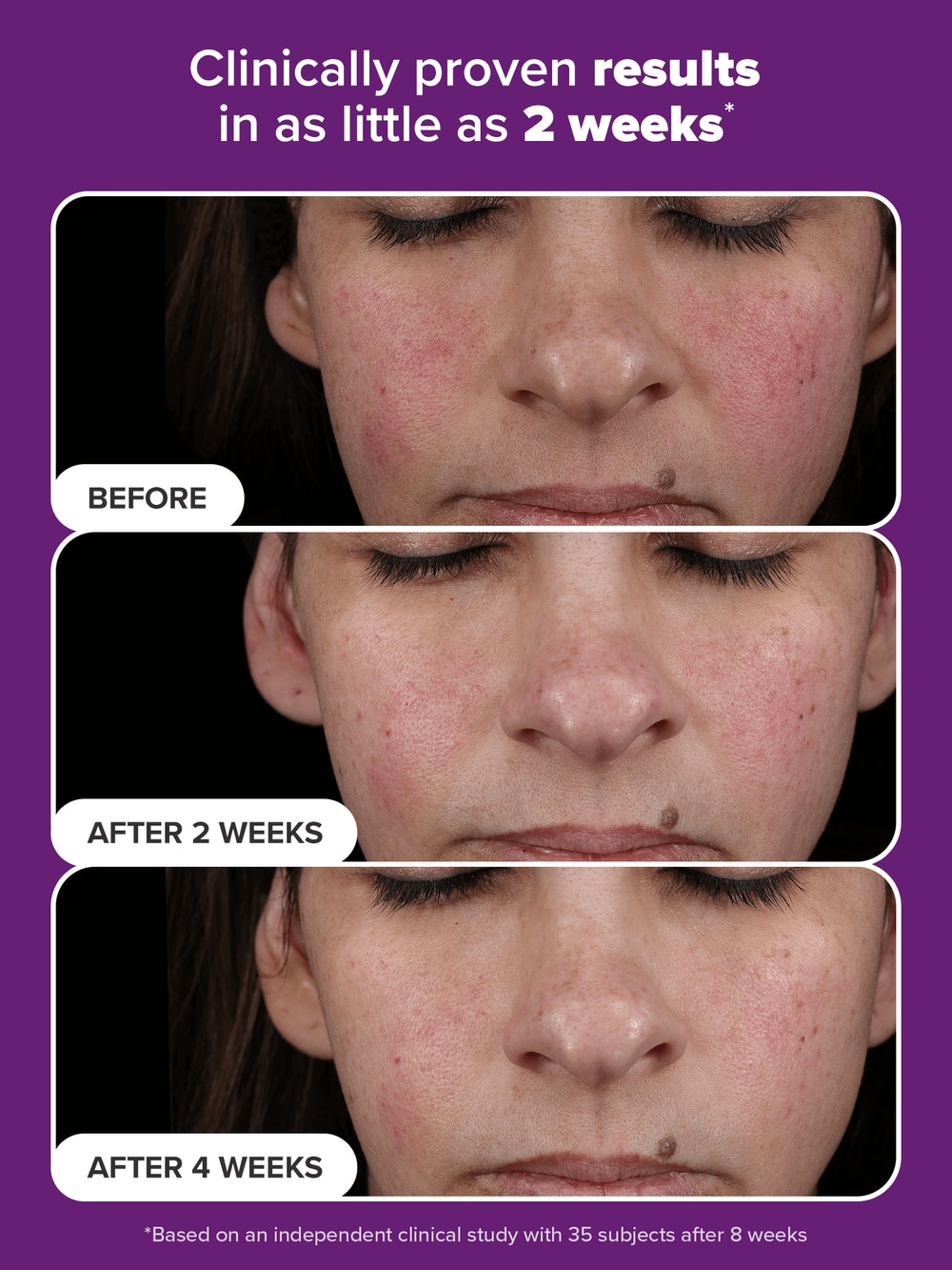 CLINICAL PRO Retinaldehyde Treatment | Paula's Choice Australia