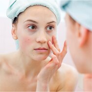 How to Minimize the Look of Post-Acne Marks